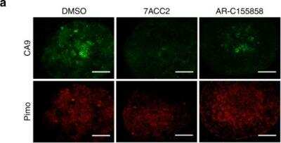 Immunofluorescent Staining of Carbonic Anhydrase IX/CA9 in Treated FaDu Spheroids